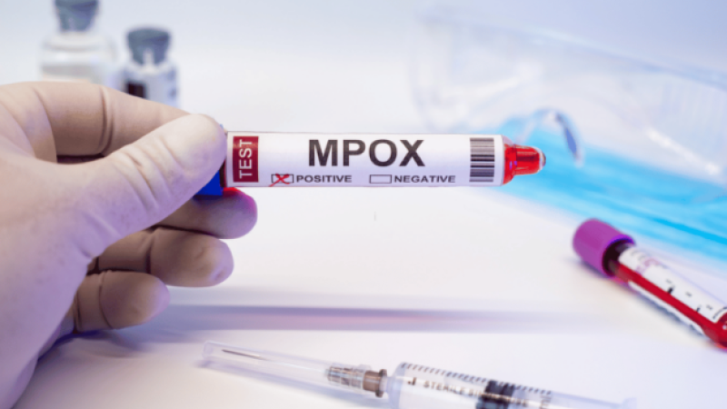 La OMC recomienda trabajar en acciones preventivas y reforzar el SNS ante la mpox