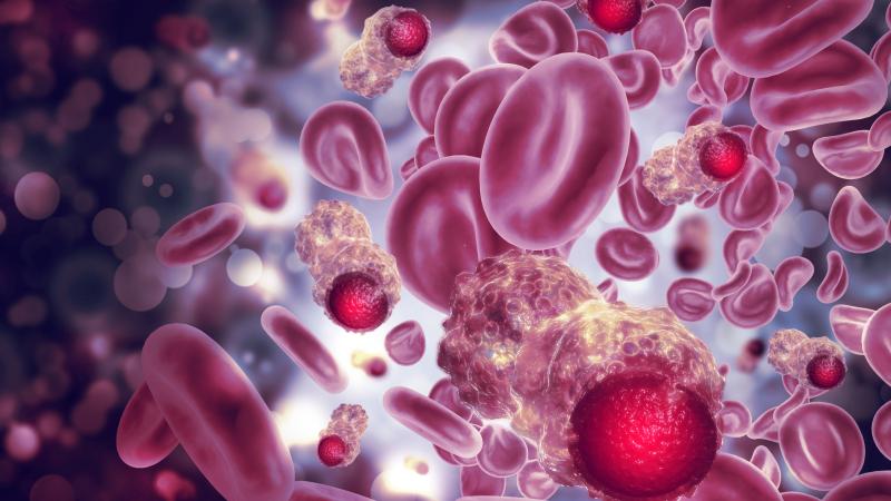 cáncer sangre