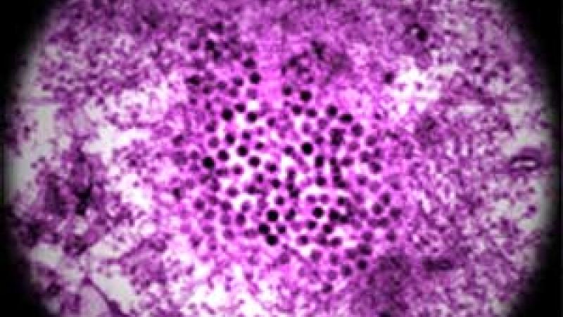 Virus Nilo