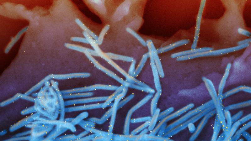 respiratory syncytial virus