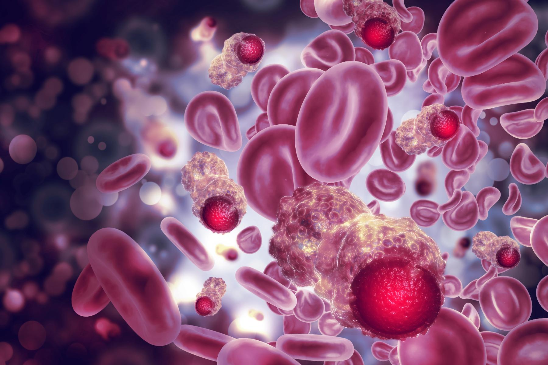 cáncer sangre