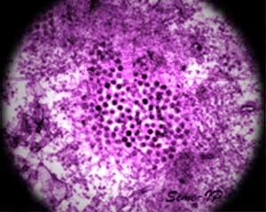 Virus Nilo