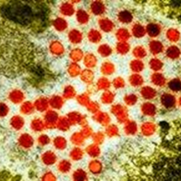 hepatitis