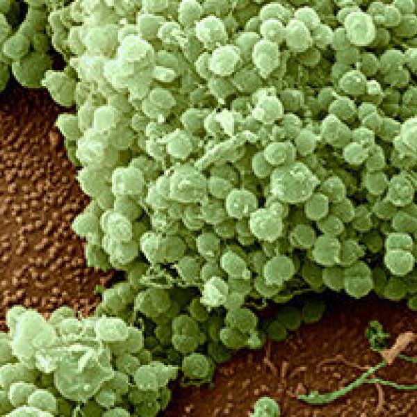 gonorrea