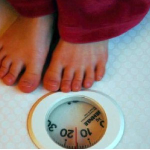 obesidad