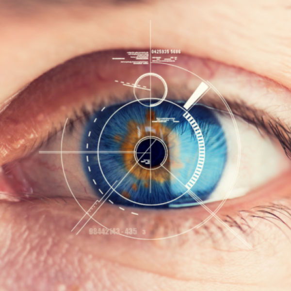 ojo