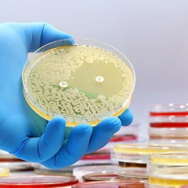 Resistencia antimicrobiana