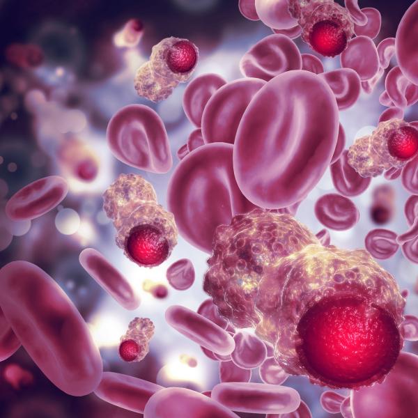 cáncer sangre