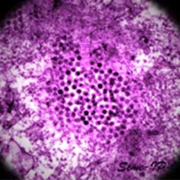 Virus Nilo