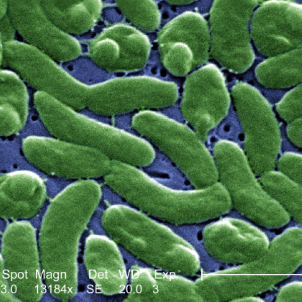 Vibrio